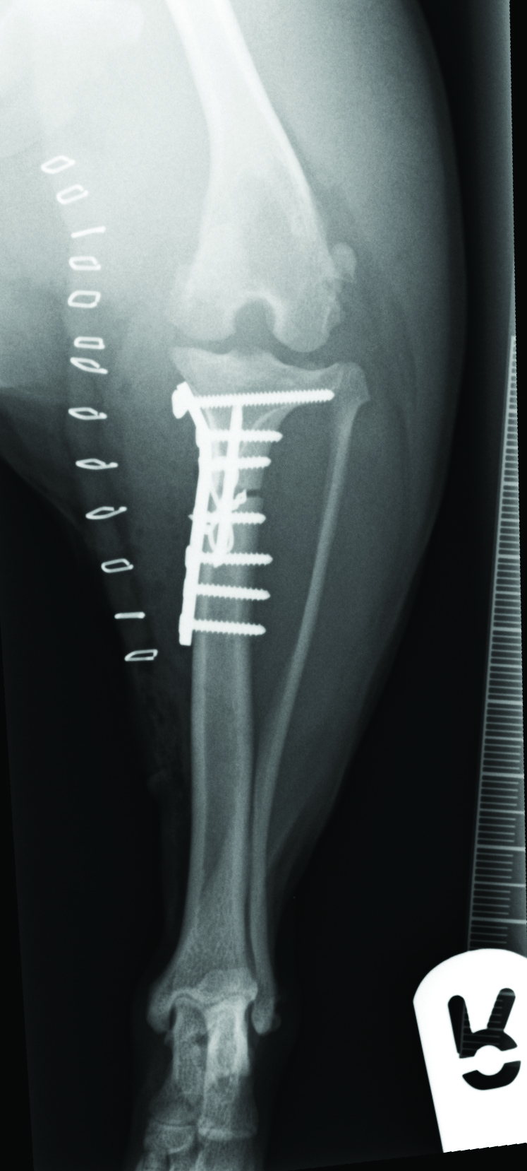 TPLO by Wedge Osteotomy
